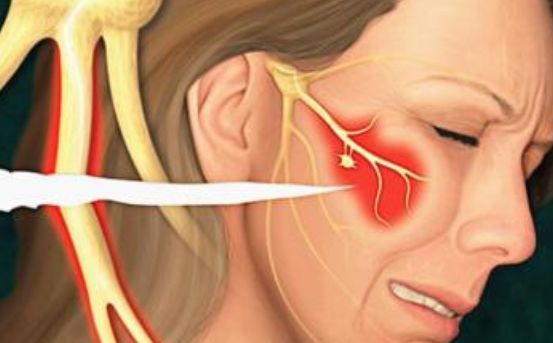 睁着眼睛打喷嚏,会把眼球打出来吗?