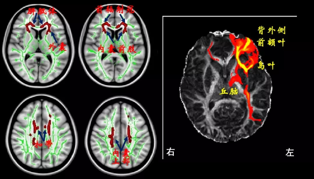 《科学大家》专栏| 网络游戏成瘾是种病:为了研究课