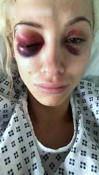 女模特收好友劝分短信,遭男友抓个正着