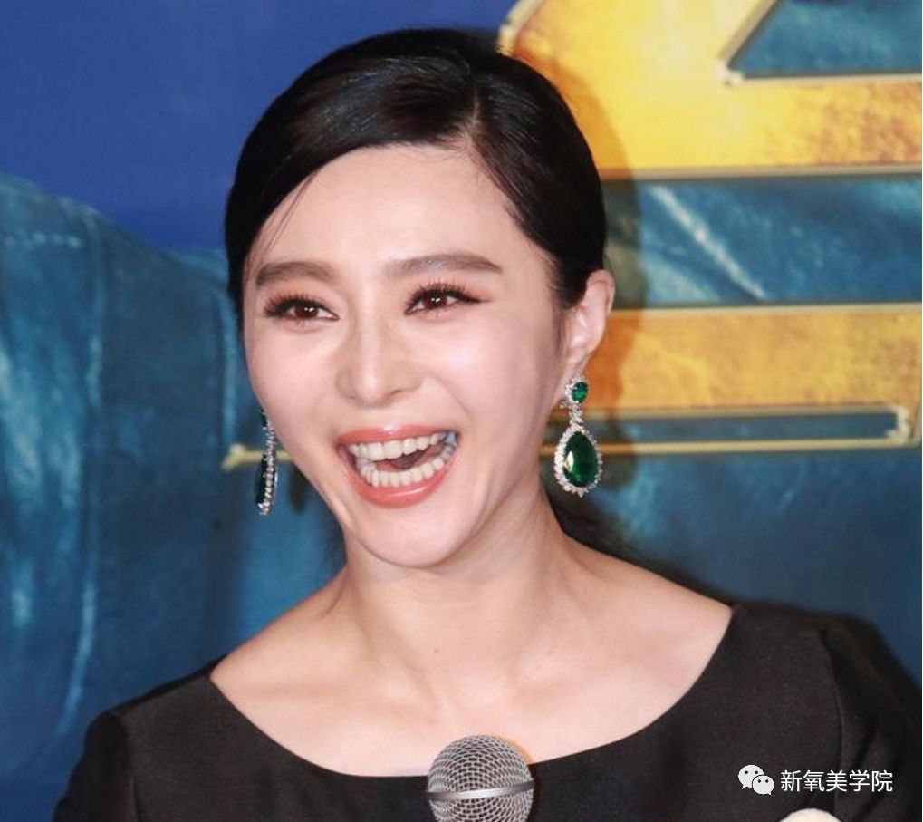 范冰冰怎么又双叒叕去埋线了?