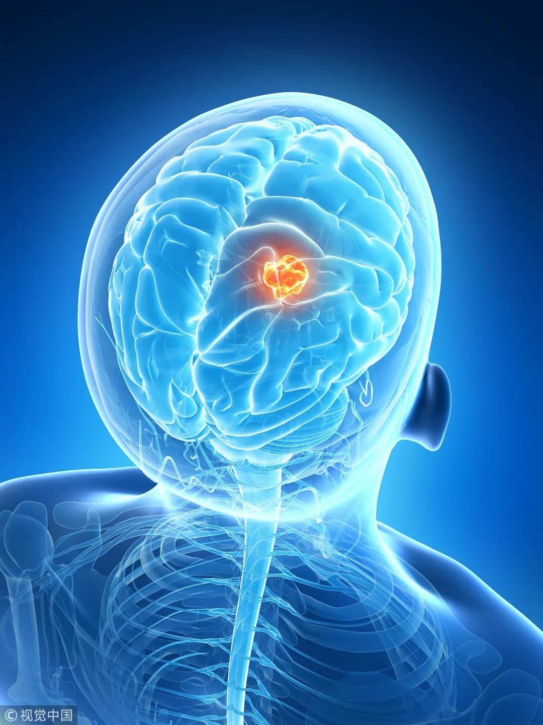 脑部结构_脑部结构图