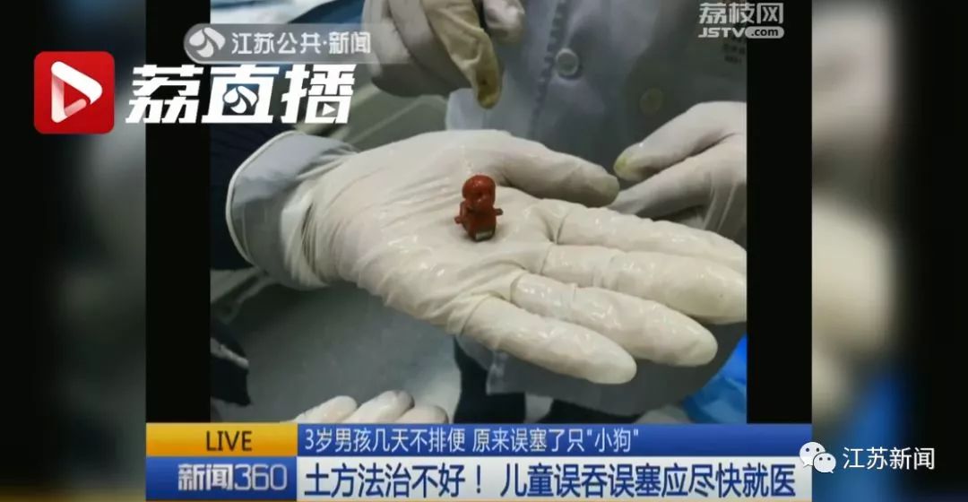 南京3岁男孩几天未大便在他身体里竟取出这东西家家都有