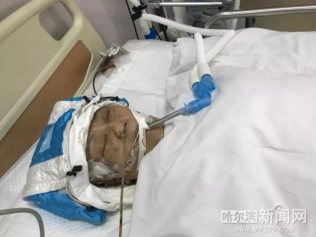 快过年了,看看谁家的妈妈还没回家丨昨天在建国街摔伤了头现仍昏迷中