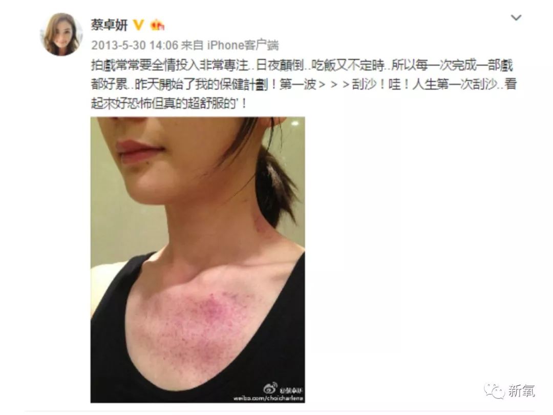 女艺人阿娇晒出一张照片,网友都炸了!医生都看不下去了