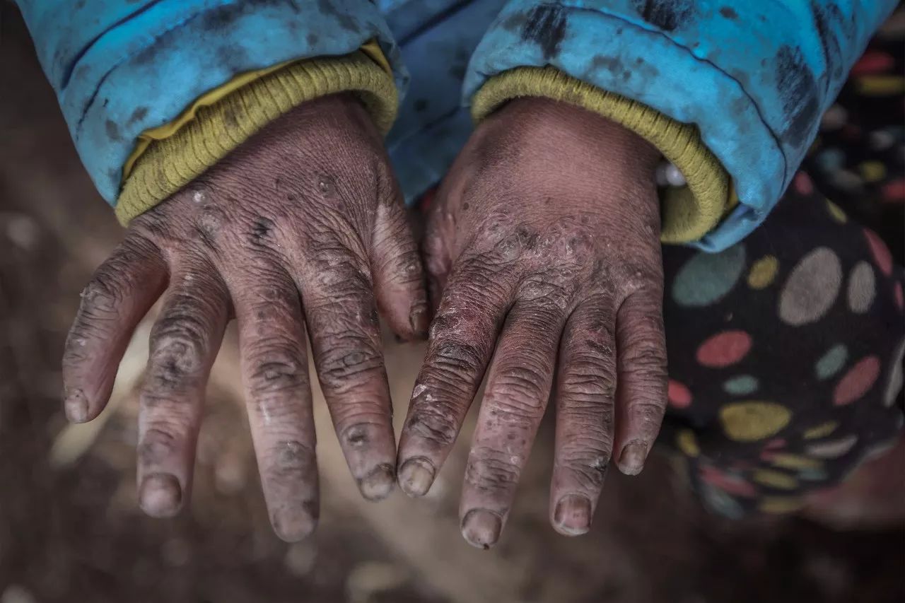 "冰花男孩"重走上学路 学生途中趴地喝溪水|浙江|冰花|云南_新浪新闻