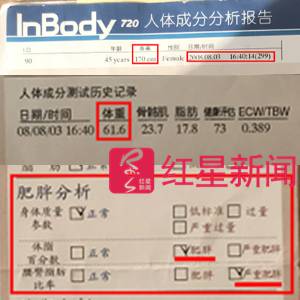整形医生王良发 ▲张津华当时在美容诊所被分析为腰臀脂肪比率“严重肥胖” 受访者供图
