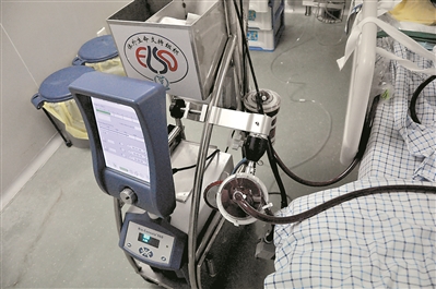 女子患重症肺炎生命垂危 人工肺支撑她18天终脱险