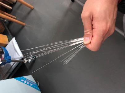 疼!几十根银针扎满左腿 "小韦德"只为更好地比赛