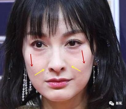 泪沟|卧蚕|张雨绮_新浪新闻