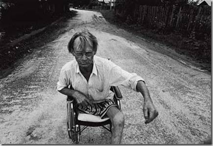 根据最新的医学报道,受到核辐射后,人体最容易患的绝症,是血友病及