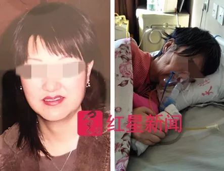 整形医生王良发 ▲张津华出事前后对比 受访者供图