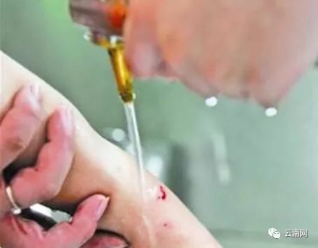 别再误会酱油了 让你的伤口变黑的不是它 手机新浪网