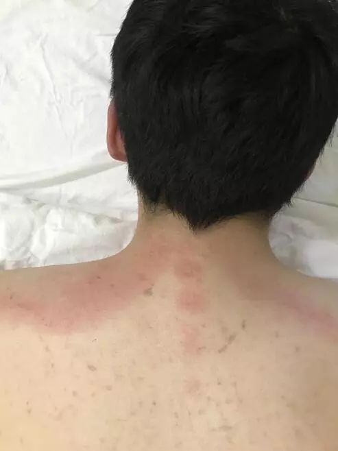 头皮发麻阿娇晒出的这张照片看过的人都炸了医生都