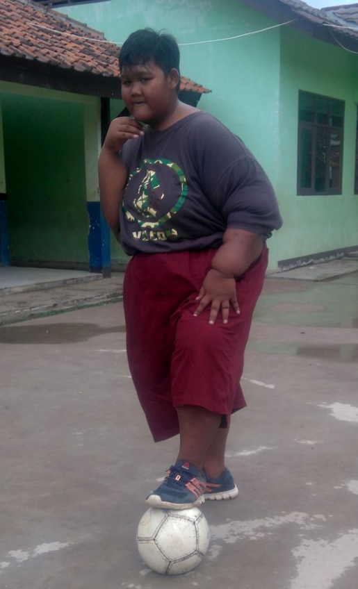 世界上最肥胖男孩减肥成功 最重时达到190公斤