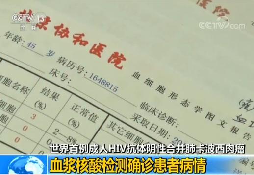 中国艾滋病病毒感染者和患者71.8万多例 仍有20到40万感染者未被发现