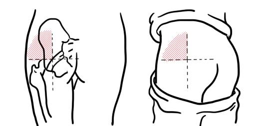 屁股招谁惹谁了?