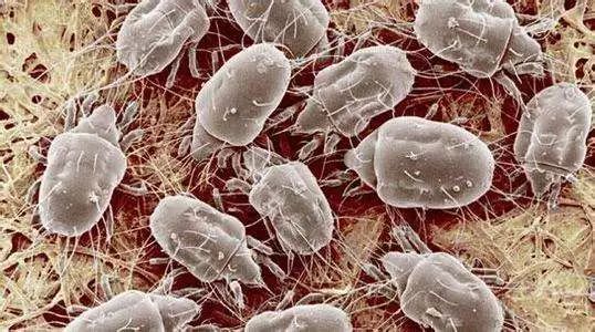 99%的螨虫和细菌