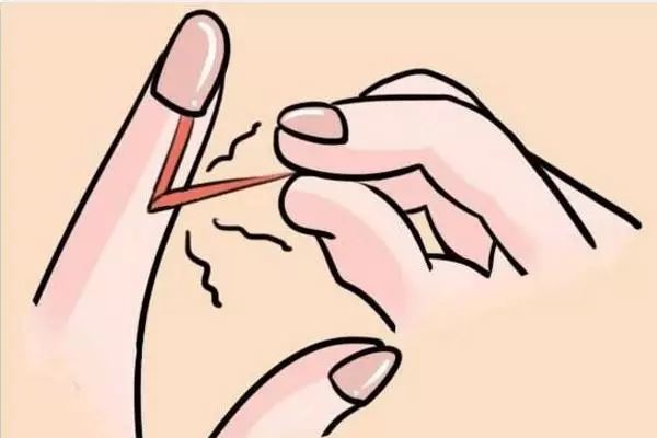 看着就疼,随手一撕,姑娘手指肿成萝卜!看完你还敢手欠吗?