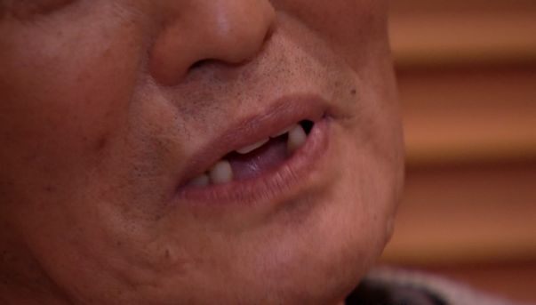 儿女急了72岁老人胃总闹情绪罪魁祸首竟是它这个问题也开始年轻化