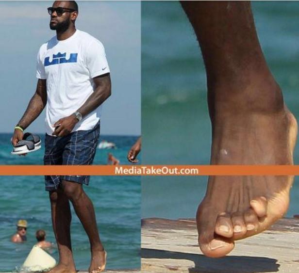 nba球星真不容易,詹姆斯的脚趾严重变形,乔丹食指不能弯曲