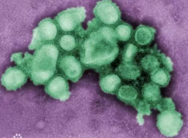 警惕！流感病毒悄然转变，甲型H1N1来了！济南疾控中心发布消息…