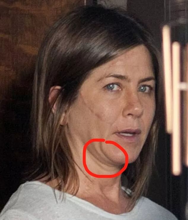 发际线还是脖子你照镜子先看哪里