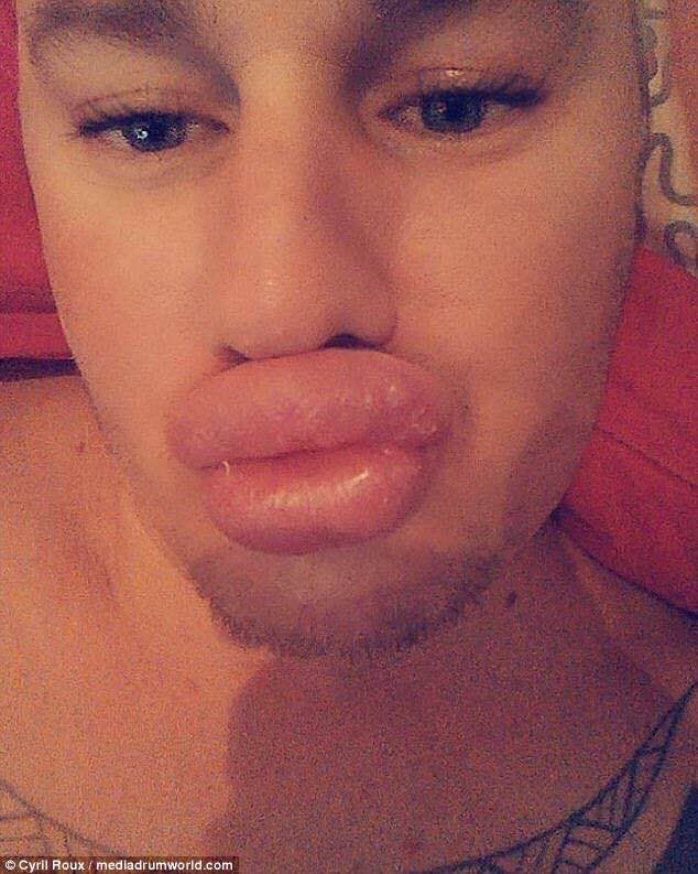 法国大哥为把自己整容成梦露,丰唇就花费超过3500英镑!丨周末趣读