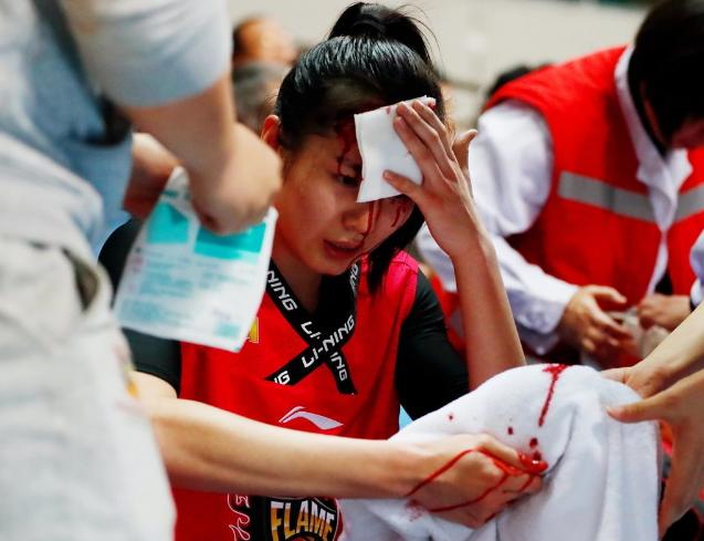 我们希望女篮的队员在比赛中有好的发挥,但是更要注意不要受伤!