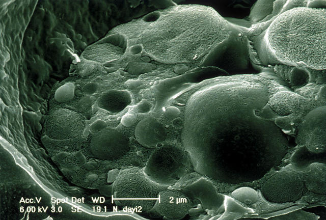 凶手是一种真菌——蛙壶菌(batrachochytrium dendrobatidis),常缩写