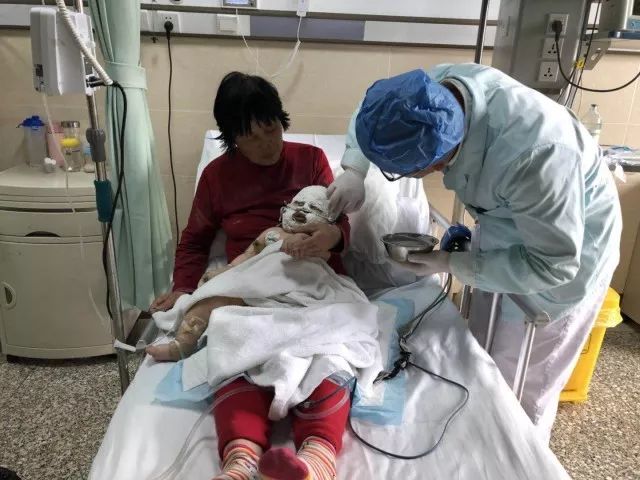 惋惜!安徽6个月大婴儿被这东西严重烧伤!家长一定要注意!