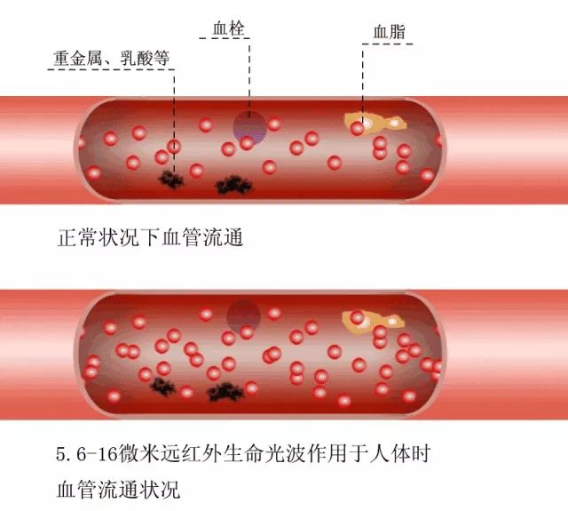 原来这才是“血管堵塞”的真相!保持这些习惯可以清血管...|血管|苹果|饮食_新浪新闻