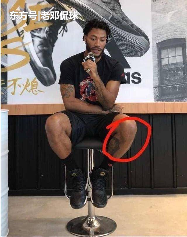 想在nba成功有多难?看了科比的跟腱 布泽尔的手指你就懂