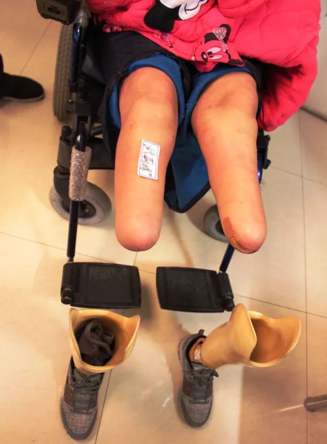 鉴定人讲述 | 高二女生被强奸后遭二次抛弃,双目失明,颅内受损.