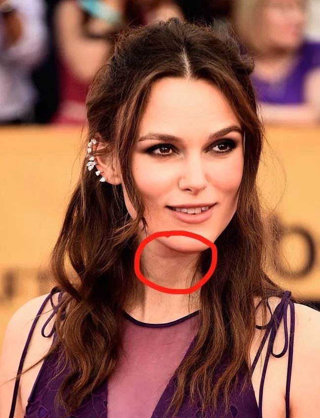 发际线还是脖子你照镜子先看哪里