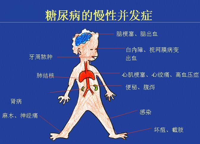 医生建议徐滨华建议,糖尿病胃轻瘫患者应少食多餐,避免生的或未煮熟的