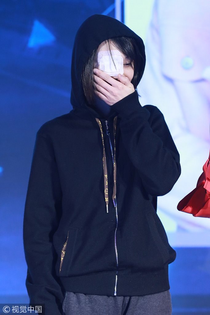 小迷糊!郑爽撞柜门受伤变"独眼侠" 搞怪猫腰下台表情可爱