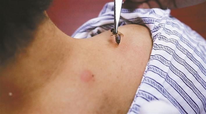 他专门养蜂蛰人还很受欢迎