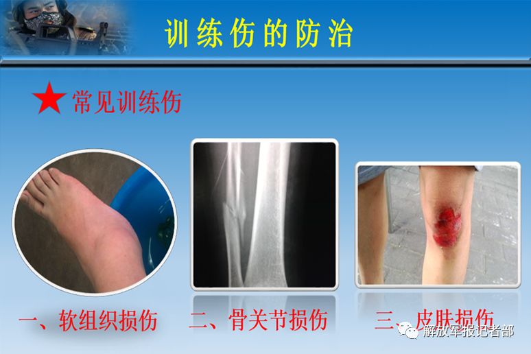 训练保护意识不强导致训练伤怎么办?