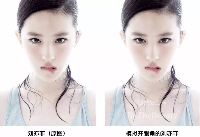 这个刘亦菲刘诗诗黄圣依都有的颜值bug究竟要如何解决