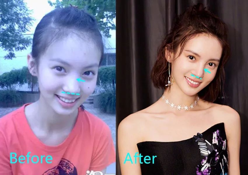 金晨状告唐人违约败诉,公司不捧她的原因是.