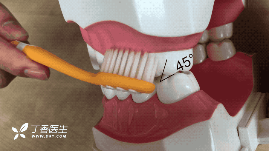 可以试试牙科医生非常推荐「巴氏刷牙法」.