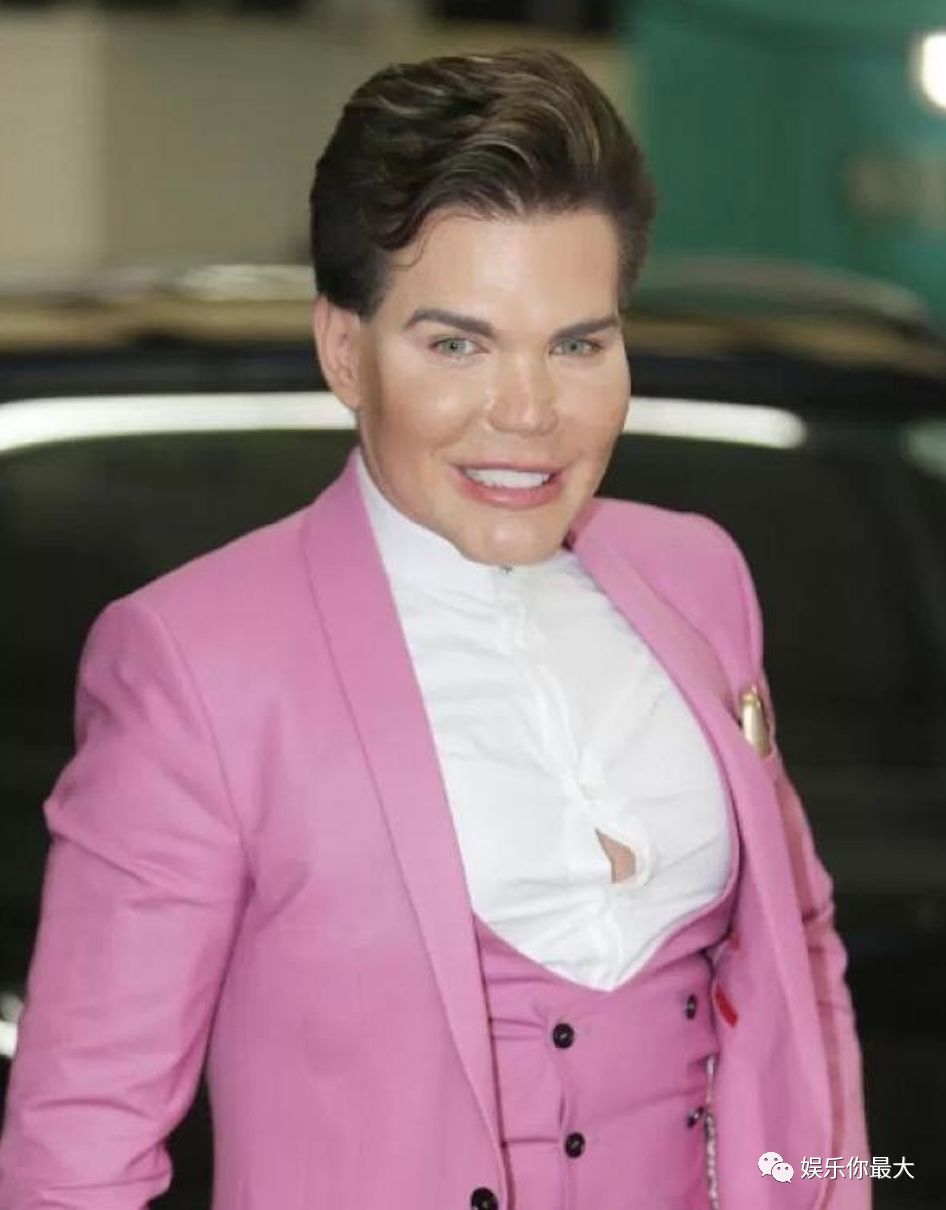 就是辣个从 18 岁开始,为了把自己整成芭比男友ken,至今已经动了60次