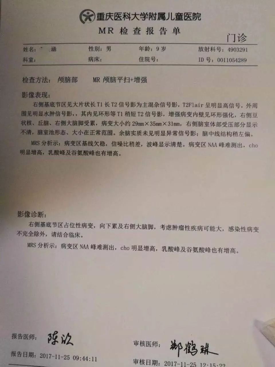紧急求助丨涵涵确诊四级弥漫中线胶质瘤,救救可爱的冰娃!