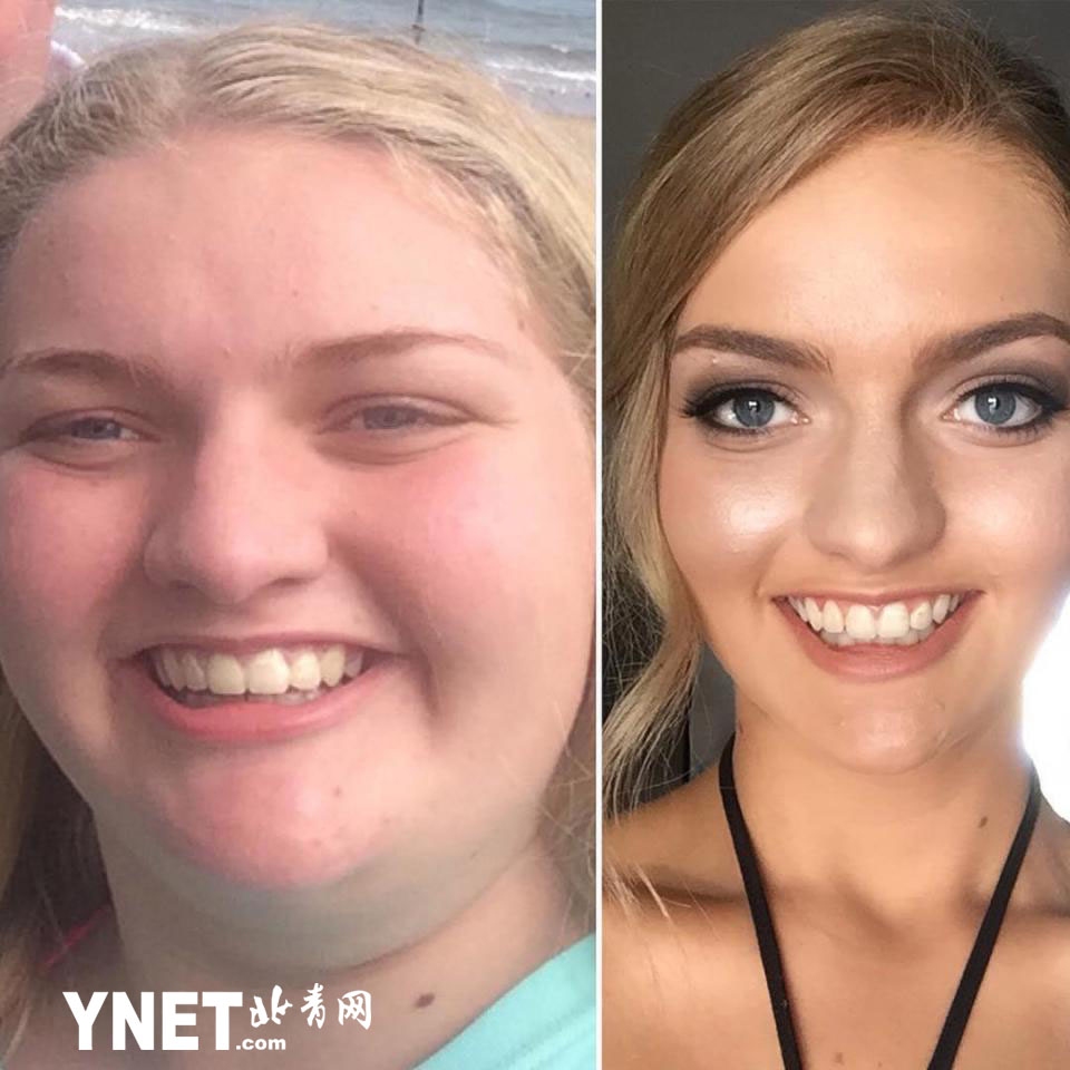 真人版丑女大翻身:300斤少女11个月减掉一半体重成女神