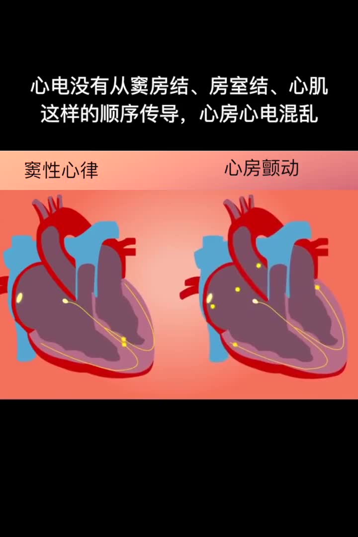 哈医大一院房颤中心医疗主任 梁兆光教授_手机新浪网