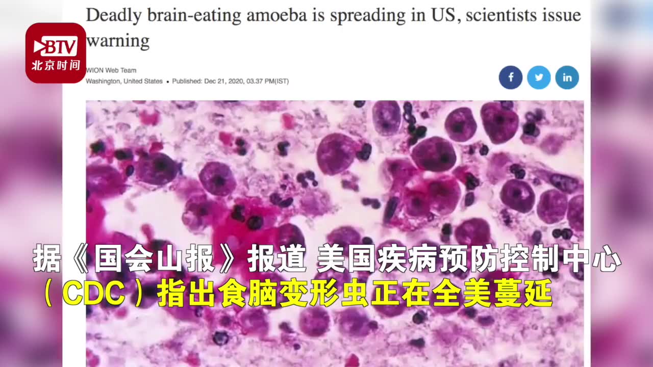食脑变形虫正在美国蔓延 或与全球气候变暖有关