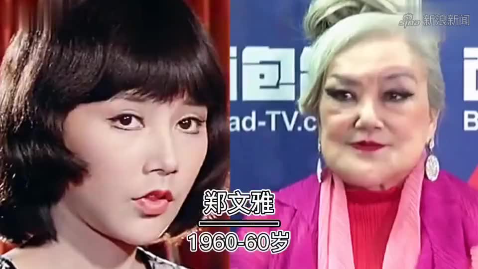 10大整容女星对比,没有最丑只有更丑,邵音音张檬简直惨不忍睹!