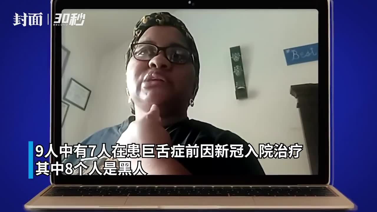 30秒|美国多名新冠患者出现"巨舌症 医生:或与病毒某些特性有关