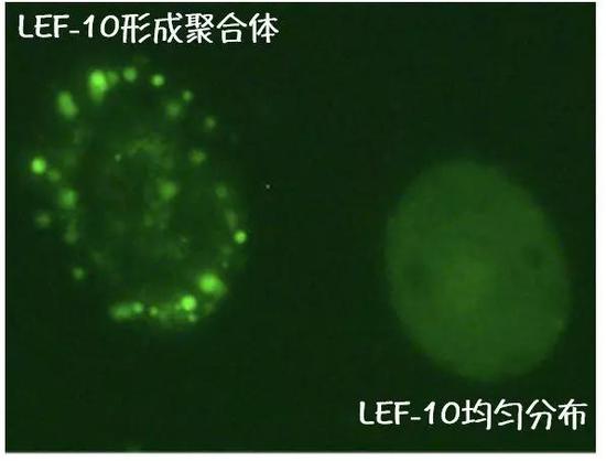 LEF-10聚合体仅在少量细胞中出现。图片来源：参考文献[1]