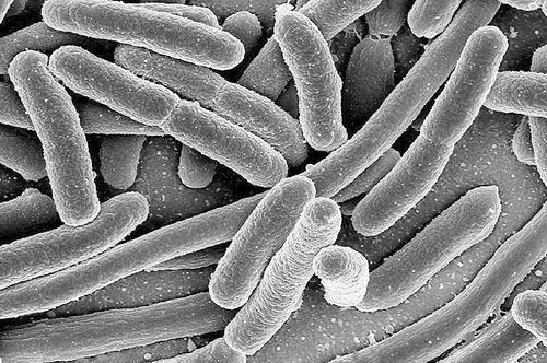 特定大肠杆菌菌株或同肠癌存在关联。图片来源：NIAID/CDC/SCIENCE PHOTO LIBRARY